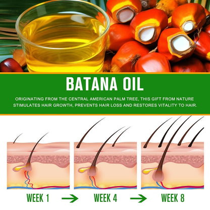 RootBloom™ 100% Pure Batana Hair Oil